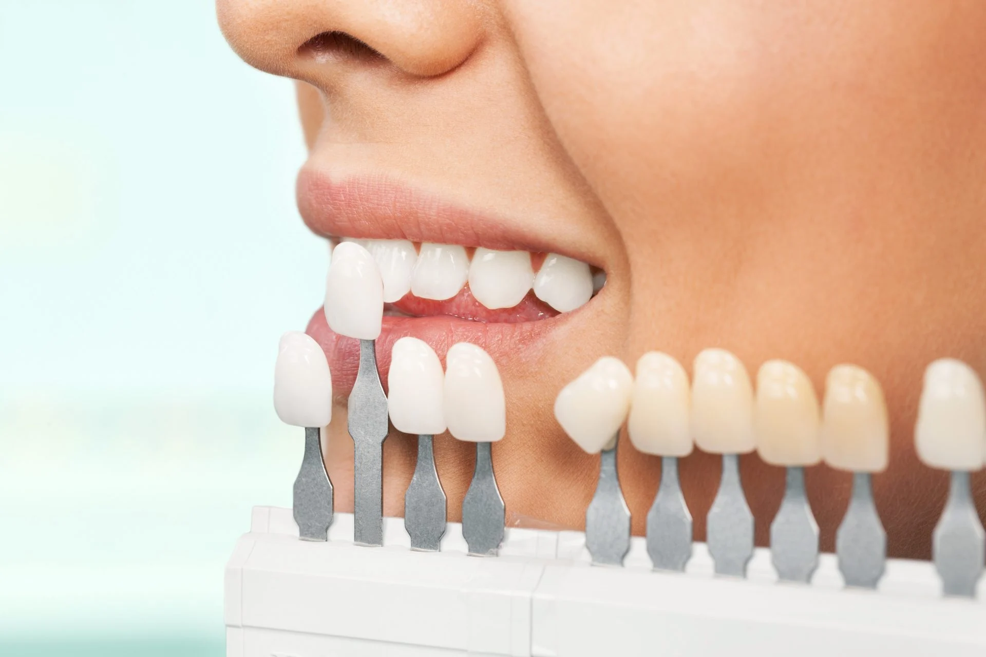 Woman’s smile beside a dental shade guide