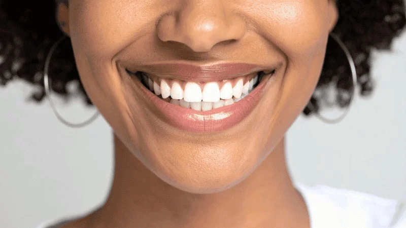 full mouth dental implant recovery time