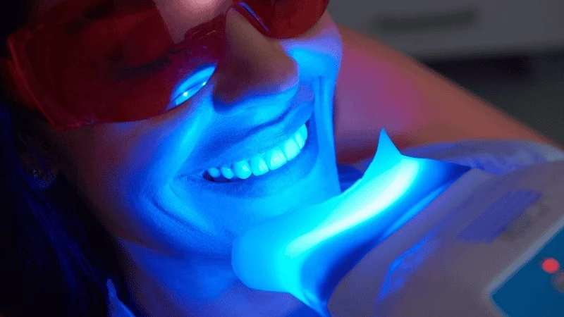 Teeth Whitening and Smile Makeovers