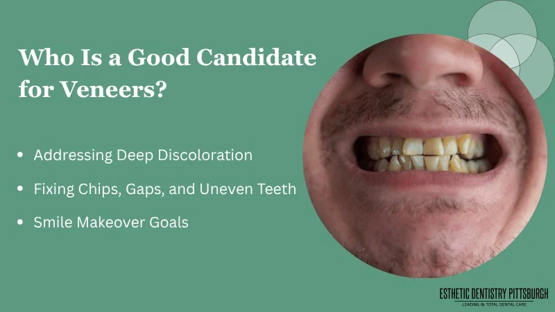 Who Should Consider Veneers