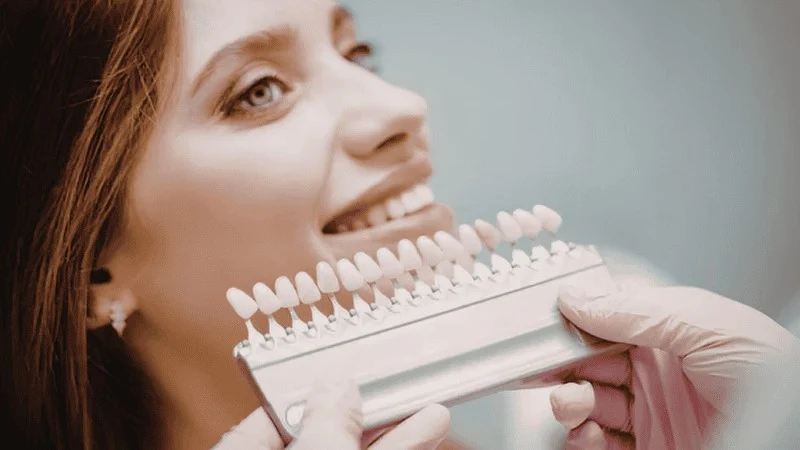 natural looking veneers