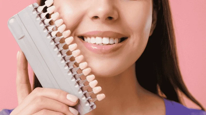 bonding vs veneers cost