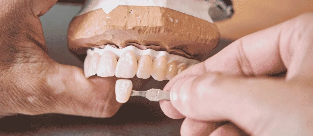Getting One Veneer Back in Harmony with Your Smile