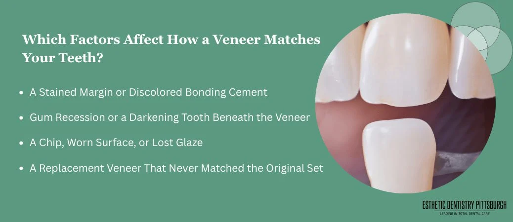 What Can Make a Single Veneer Stand Out